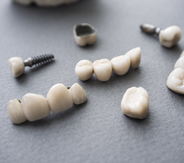 Stevensville The Difference Between Dental Implants and Mini Dental Implants