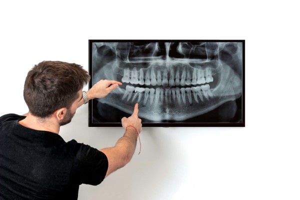 How Frequently Should You Get Oral Cancer Screenings?