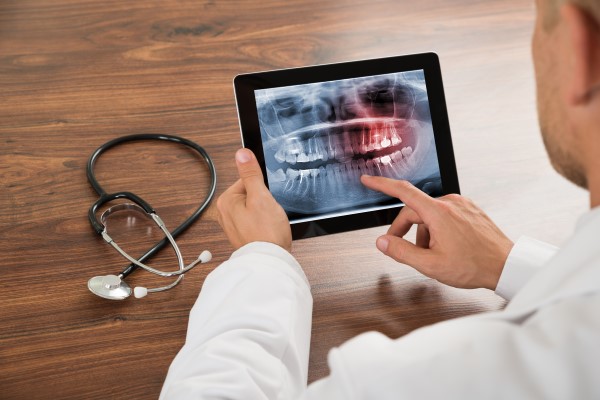 What Is An Oral Cancer Screening From A General Dentist
